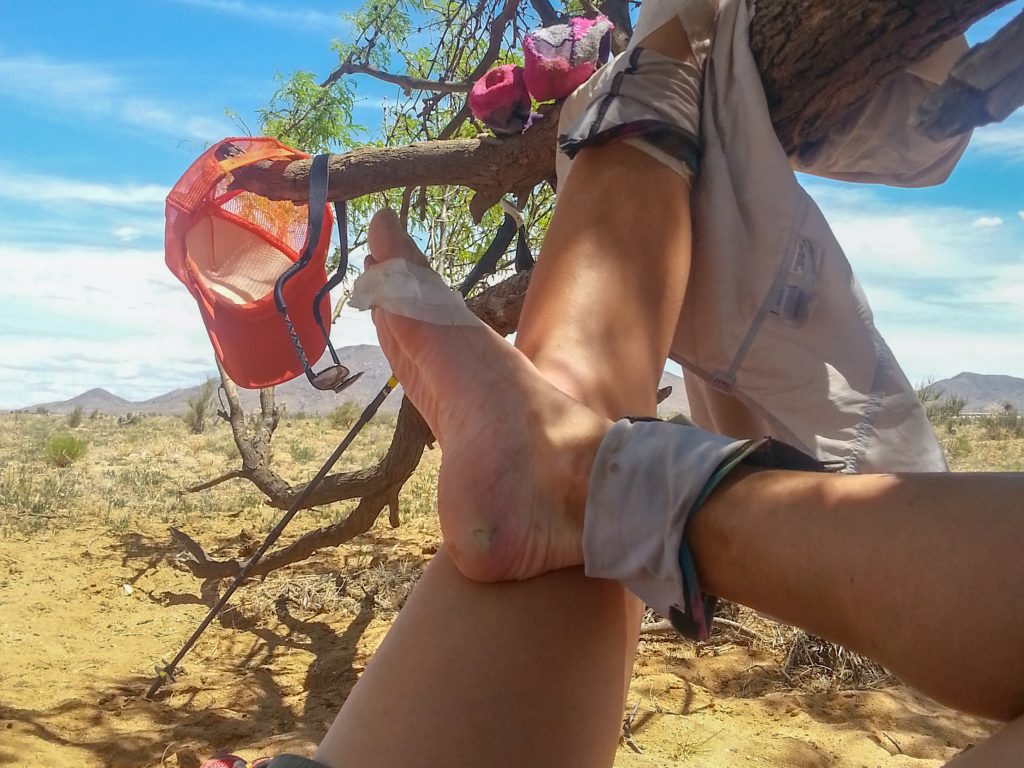 Why I Never Get Blisters - Footcare For Thru Hiking 